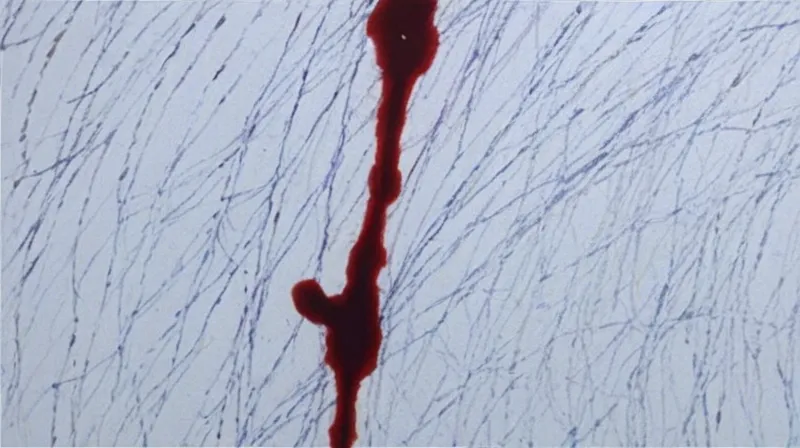 L’analisi del modello delle macchie di sangue in azione: il caso Chamberlain – L’analisi del modello